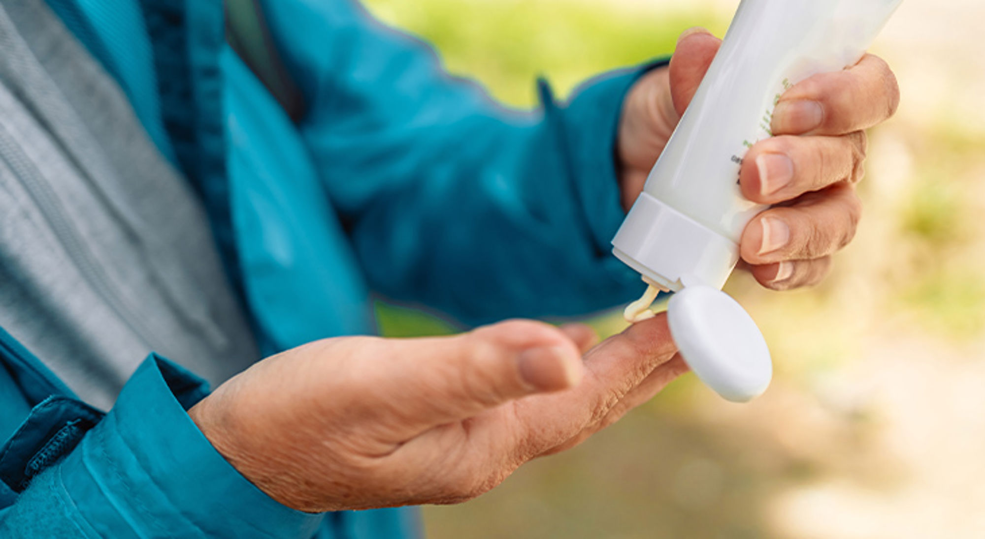 Zonnebrand smeren Zonnebrand smeren