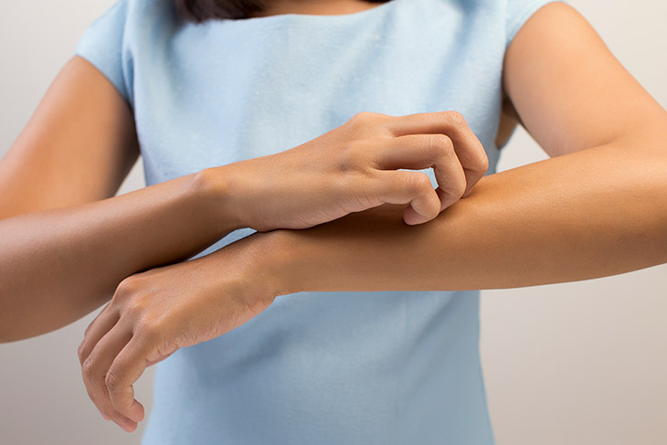 jeuk op arm van mug jeuk op arm van mug